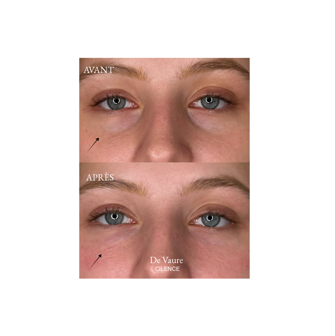 CILENCE Baume Sublime Regard - cils, sourcils et soin contour des yeux 15g